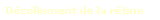 Dcollement de la rtine